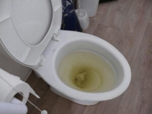 bồn cầu bị tắc do dầu mỡ