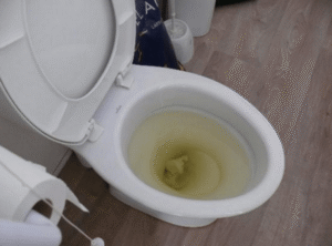 Dấu Hiệu Nhận Biết Hầm Cầu Đang Bị Tắc Nghẽn